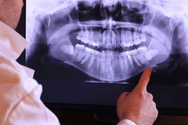 Best Emergency Dental Services for Seniors in Coalinga, CA