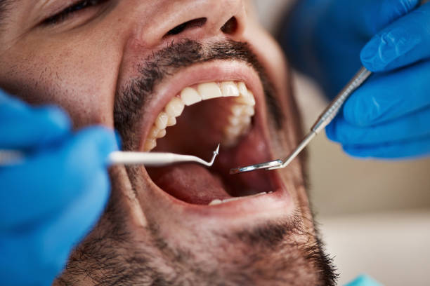 Best Mobile Emergency Dentist in Coalinga, CA